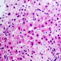 Glucagon Antibody