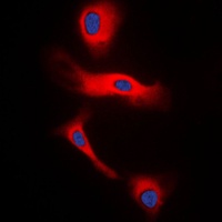 Glucagon antibody