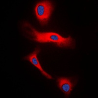 Glucagon Antibody