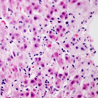 Anti-Glucagon Receptor Antibody
