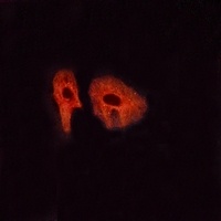 Anti-Glucagon Receptor Antibody