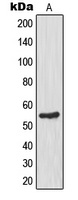 Glucokinase Rabbit Polyclonal Antibody