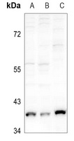 GDF1 Antibody
