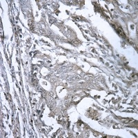 GDF1 Antibody