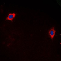 Anti-GHRH Receptor Antibody