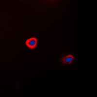 Anti-Connexin 43 Antibody