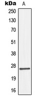 Connexin 26 Rabbit Polyclonal Antibody