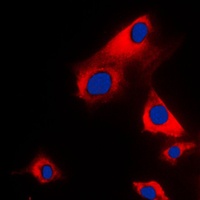Anti-Glycerol Kinase 1 Antibody