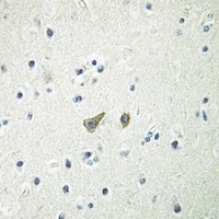 Anti-Glycerol Kinase 2 Antibody
