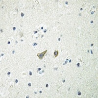 GK2 antibody