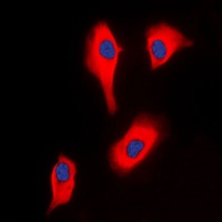 Anti-Glycerol Kinase 2 Antibody