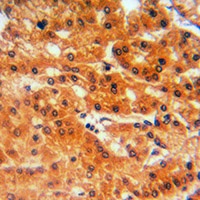 Anti-GCLC Antibody