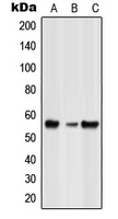 GLRB Rabbit Polyclonal Antibody