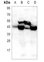 Glutamine Synthetase Rabbit Polyclonal Antibody