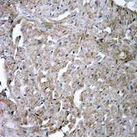 Anti-Glutamine Synthetase Antibody