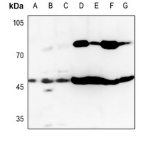 GOT1 Antibody [KO/KD Validated]