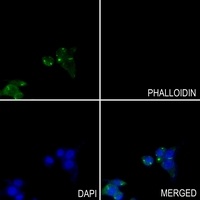 GOT1 Antibody [KO/KD Validated]