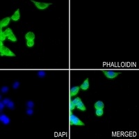 Anti-CD42c Antibody