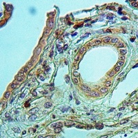 Anti-GPIPLD Antibody