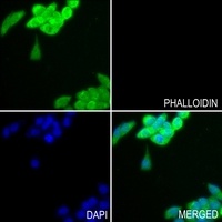 Anti-GPIPLD Antibody