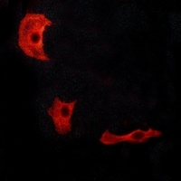 Anti-GPR17 Antibody