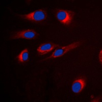 Anti-GPR18 Antibody