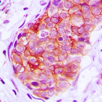 Anti-GRK6 Antibody