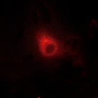 Anti-GRK6 Antibody