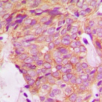 Anti-GRB14 Antibody