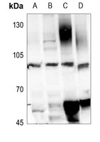 GLUR1 (Phospho-S849) Antibody