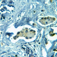 Anti-GLUR2 Antibody