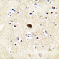 Anti-GLUR4 (Phospho-S862) Antibody