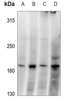 GRLF1 (Phospho-Y1087) Antibody