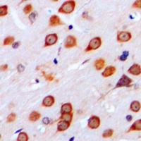 Anti-mGLUR4 Antibody