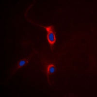 GRM4 antibody