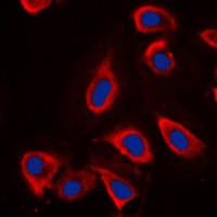 GRM6 antibody