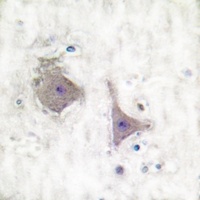 Anti-mGLUR7 Antibody