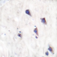 GRM8 antibody