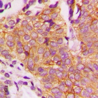 Anti-GSK3 beta (Phospho-S9) Antibody