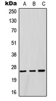 GSTM1 Antibody