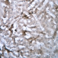 GSTM1 Antibody