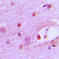 Anti-MSH6 Antibody