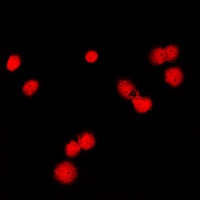 Anti-MSH6 Antibody