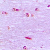 Anti-BRF1 Antibody