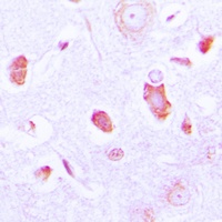 Anti-GUCY1A3 Antibody