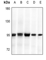 GYS1 Antibody [KO/KD Validated]