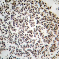 GYS1 Antibody [KO/KD Validated]