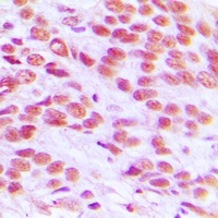 Anti-Histone H2A.X Antibody