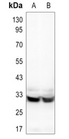 HCCS Antibody