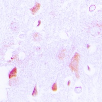 Anti-HCCS Antibody